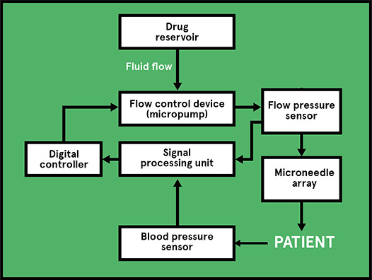 A diagram showing how pressure sensors are used to control drug delivery