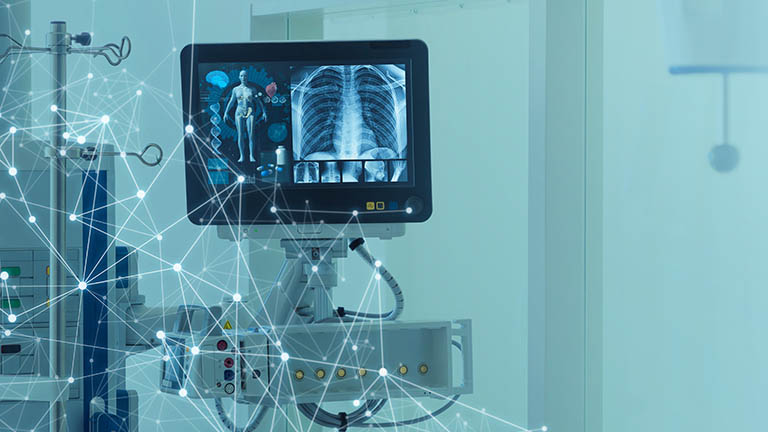 An x-ray being displayed on a hospital monitor